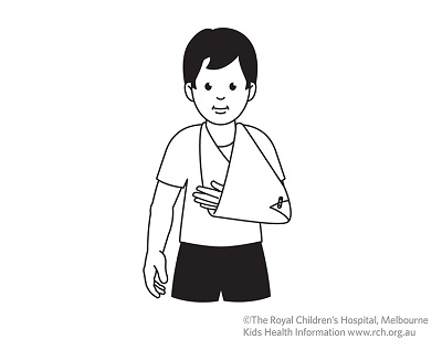 Fracture care: arm in sling