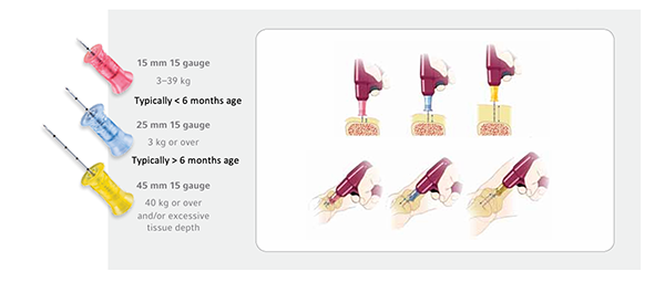 Equipment  - Intraosseous access 