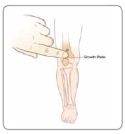 Distal tibia: 1-2 cm