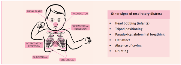 Other signs of respiratory distress