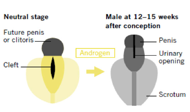 Complete Androgen Insensitivity Syndrome Diagram