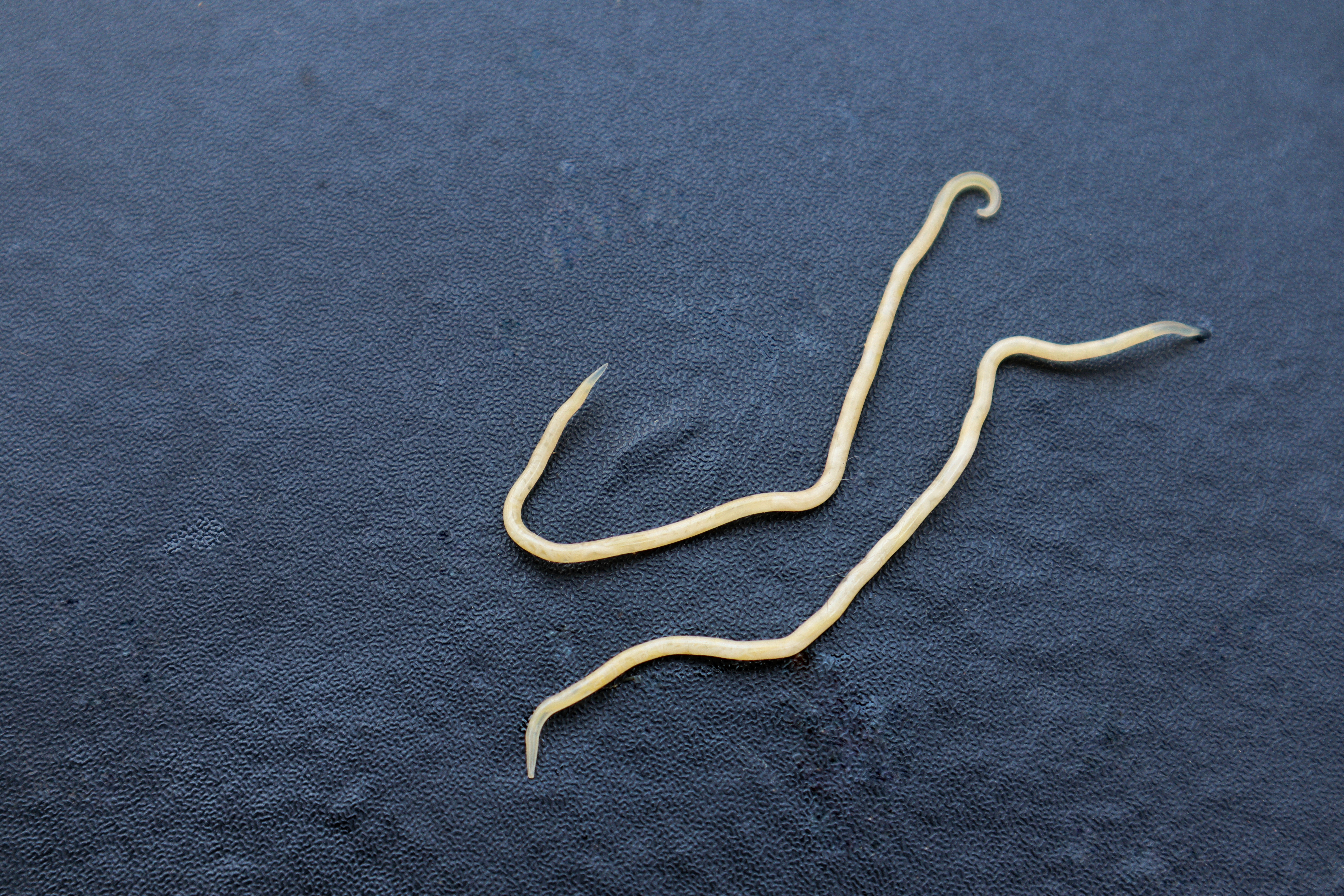 Threadworms close up Threadworms close up