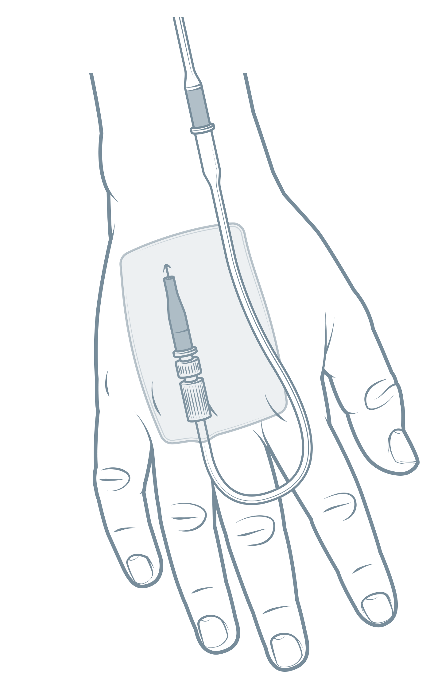 intravenous line