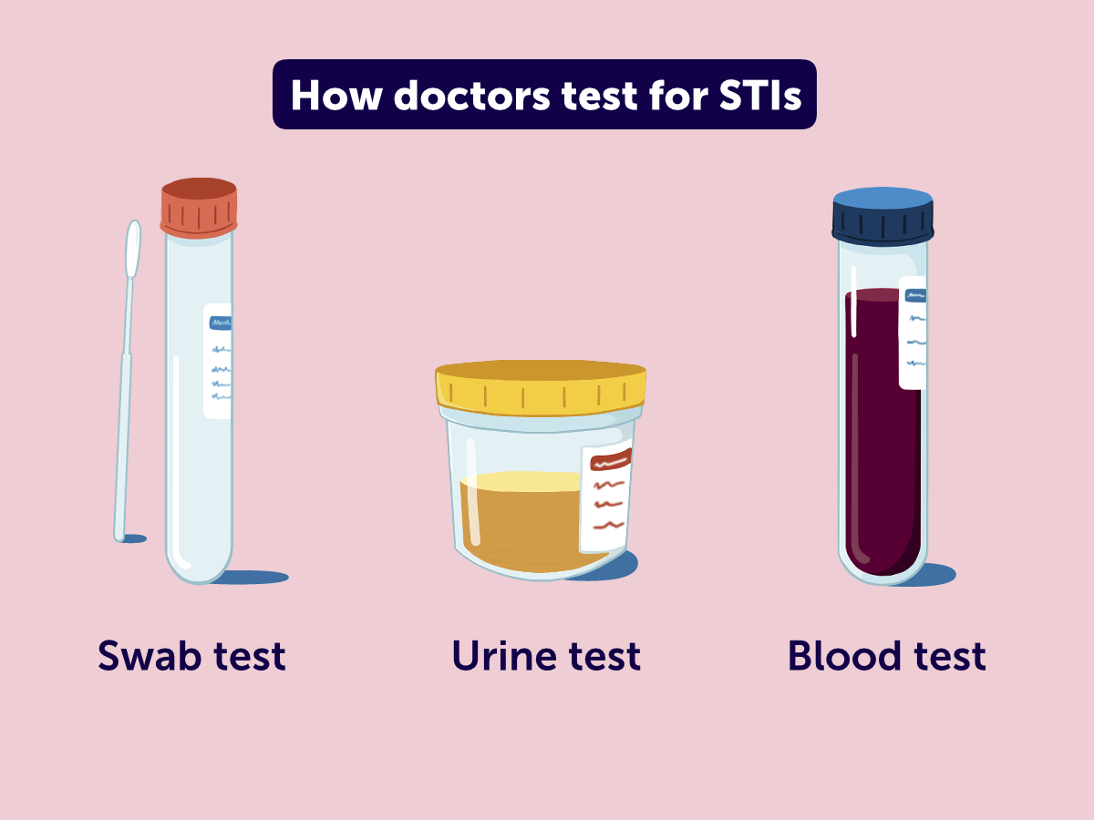 20260331_THI_STIs_Illustration_STITesting Illustration with the three main test types of STIs.